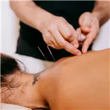 TERAPIE Akupunktura   60 minut
