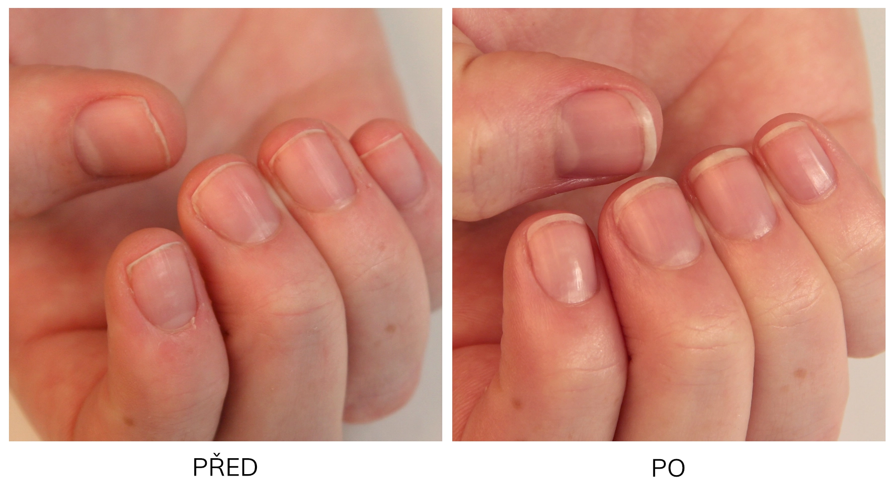 Proměna nehtu Proměna nehtu