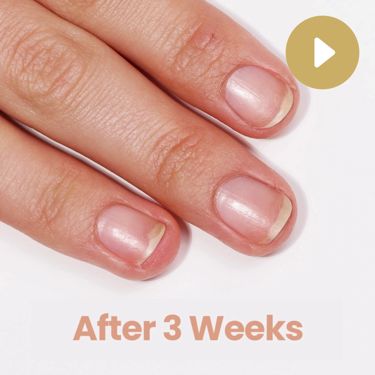 Video LONDONTOWN kur Get Well Nail Recovery nápravná starostlivosť na nechty