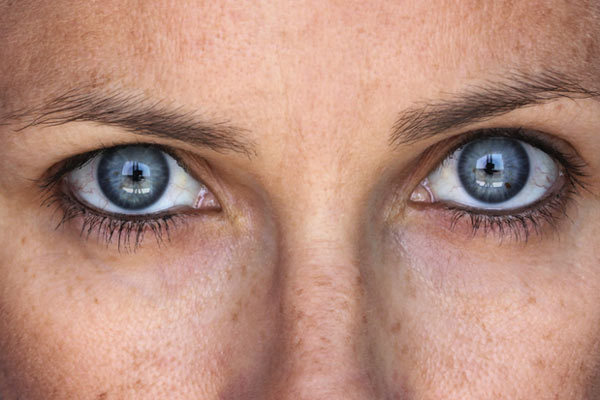 melanogeneze a pigmentové skvrny